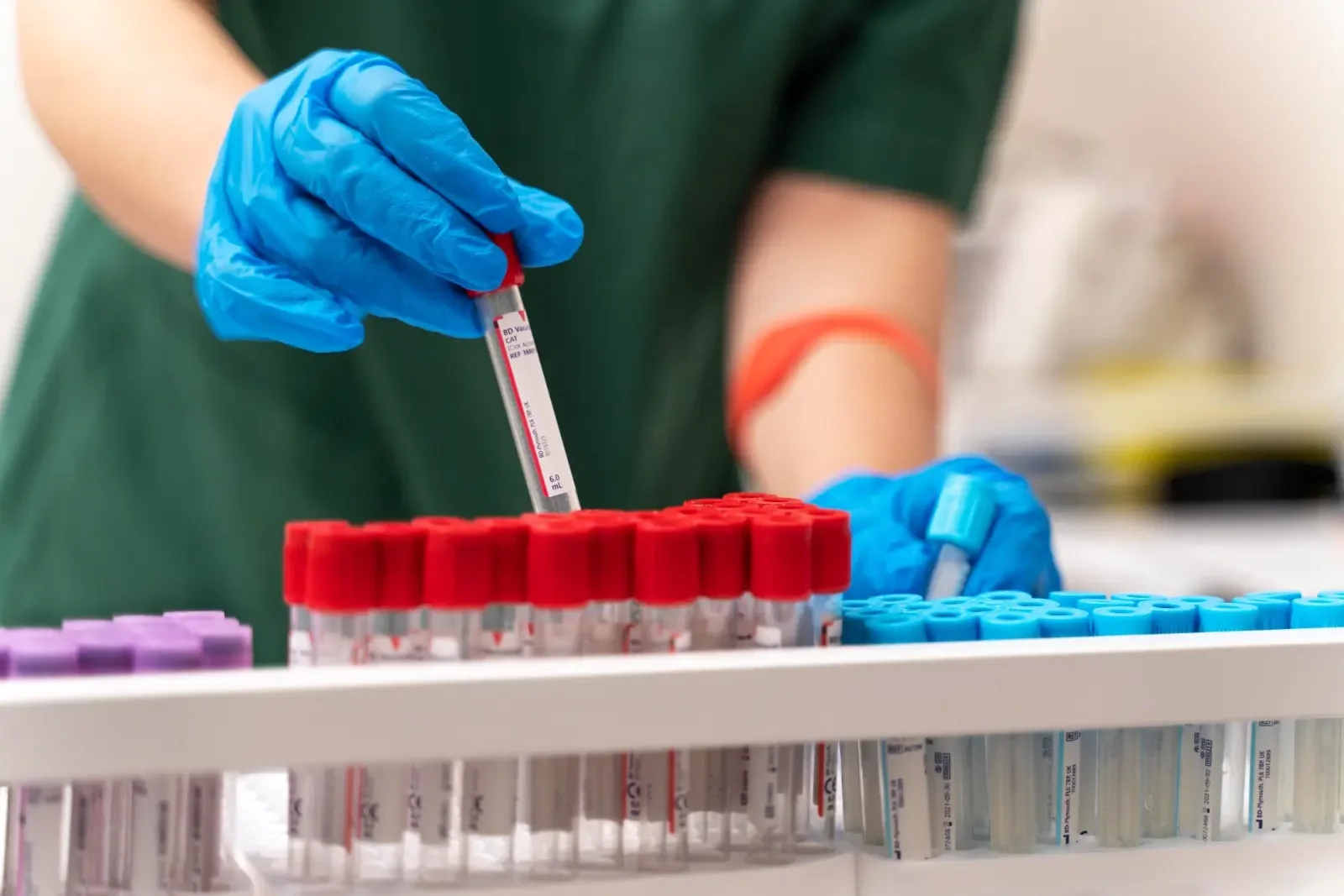 Goiânia amplia serviços de saúde com exames laboratoriais aos sábados