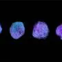 Even a slight overproduction of tubulin can tip the balance of cellular health, study shows