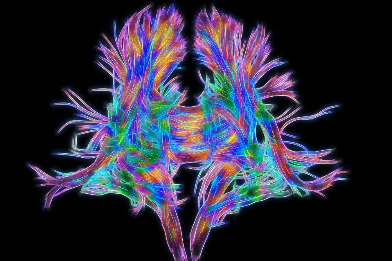 Most neurons seem to be jacks-of-all-trades, not specialists