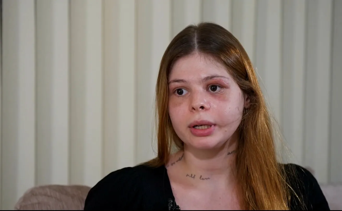 Médica agredida relata dificuldades emocionais após ataque violento