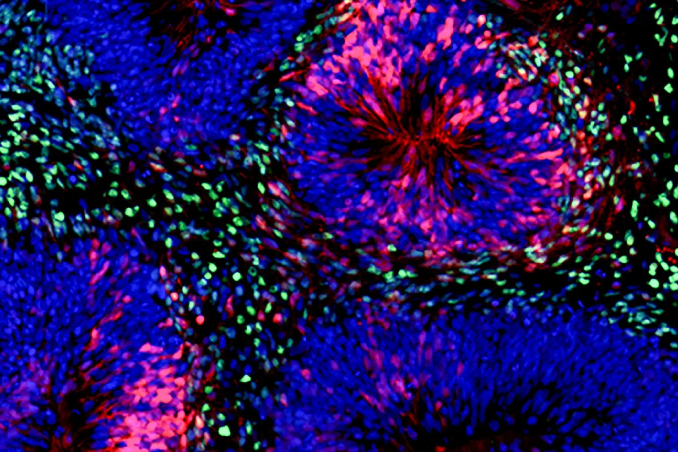 Organoid cerebral de 5 anos sente passagem do tempo