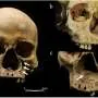 Descoberta de esqueleto medieval pode revelar primeira evidência de castigo brutal