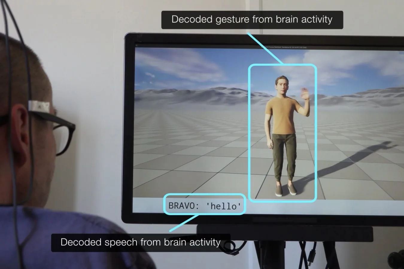Implante cerebral permite comunicação mais precisa para pessoas com paralisia