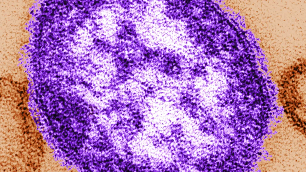 Coroners release details of infants who died during Pennsylvania measles outbreak