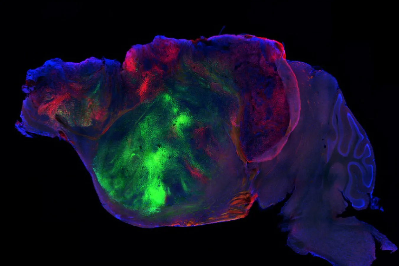Organoidas humanas restauram cognição em roedores