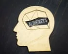 Novo estudo busca prevenir Alzheimer antes dos sintomas