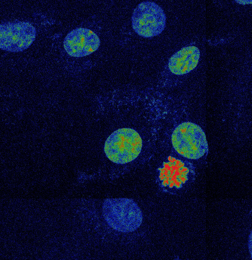 Novo estudo identifica papel do sistema imunológico na aceleração do envelhecimento