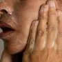 Adult acne: Understanding and treating common skin issues