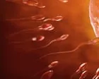 Primeira transplante de tecido testicular realizado no Reino Unido oferece esperança para preservação da fertilidade