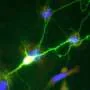 Tecnologia nanosscale avança descobertas sobre doenças neurodegenerativas