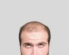 Fatos fascinantes sobre o cabelo humano