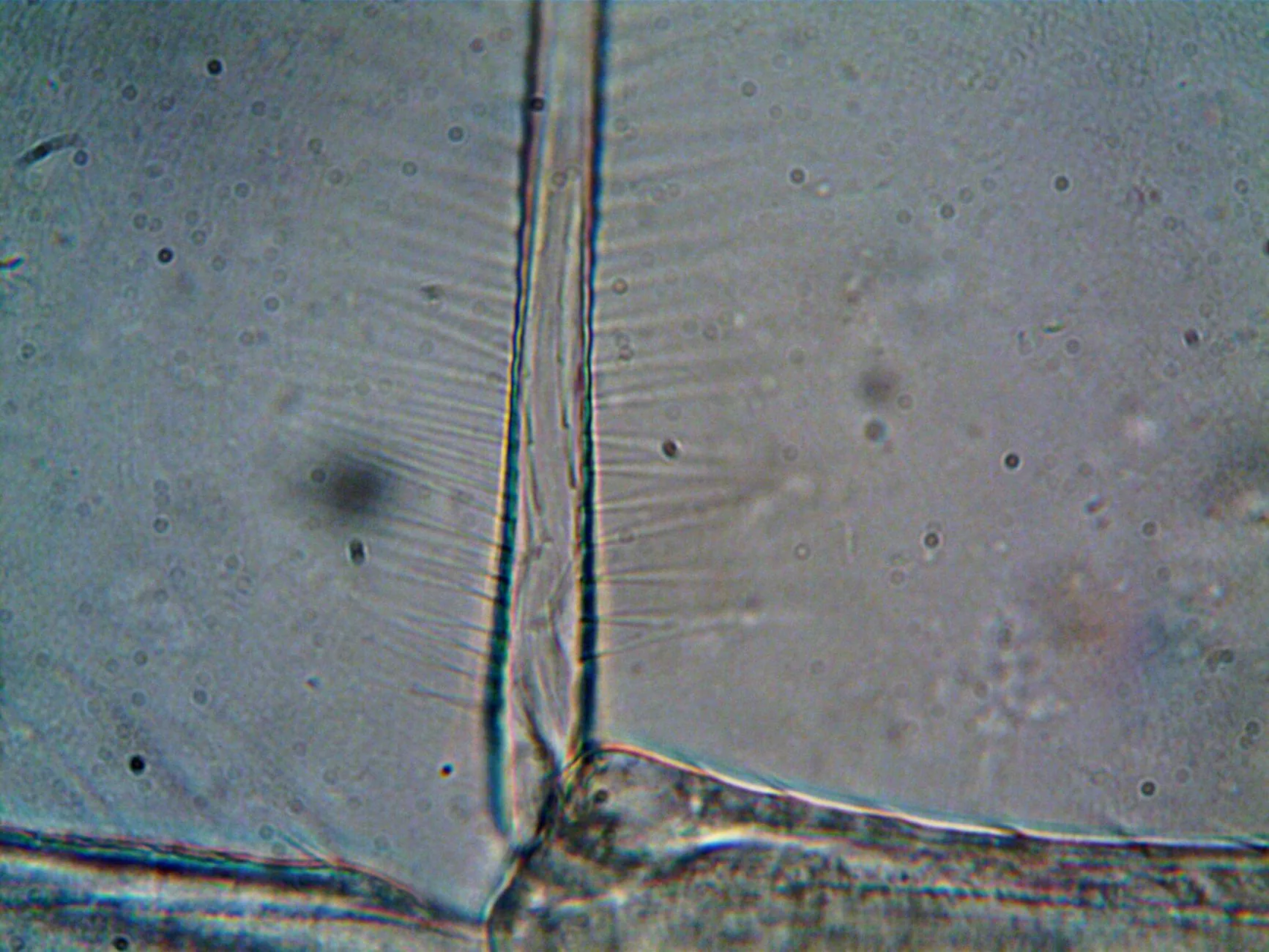 Cientistas descobrem por que estatinas causam dor muscular